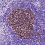 discovery-of-a-novel-v