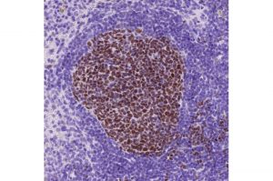 discovery-of-a-novel-v