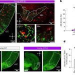 dopamine-deficiency-fo