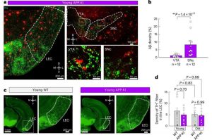 dopamine-deficiency-fo