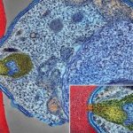 monoclonal-antibody-pr