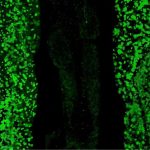 study-explores-why-fas