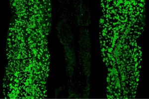 study-explores-why-fas