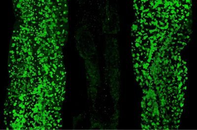 study-explores-why-fas