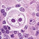 understanding-the-orig