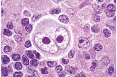 understanding-the-orig