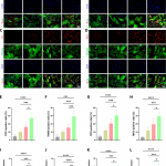 KGNPBCM-promotes-tenogenic-differentiation-of-TDSCs-invitro-A-Representative