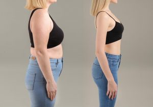 Weight-Loss-Concept-Before-and-After-1536x1075