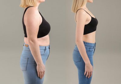 Weight-Loss-Concept-Before-and-After-1536x1075