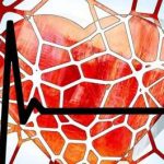 artery