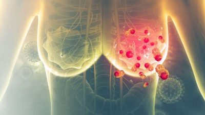 fda-approves-enhertu-a (1)