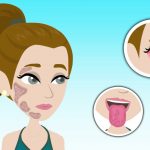 Sindrome-di-Sjogren-Article-Thumbnail-Size-1