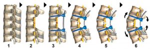 hope-for-spinal-injuri
