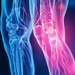 joint-pain