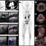 new-pet-tracer-identif