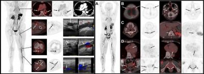 new-pet-tracer-identif