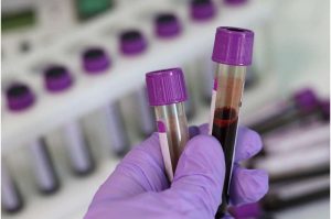 lab-blood (1)