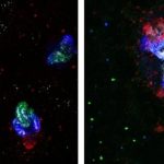 Low-Res_Organoids-Glucose-concentrations