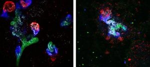 Low-Res_Organoids-Glucose-concentrations