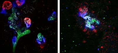 Low-Res_Organoids-Glucose-concentrations