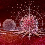 Ultrasound-Cancer-Treatment-Target