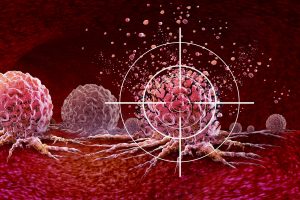 Ultrasound-Cancer-Treatment-Target