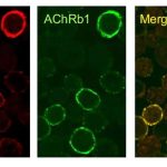 caar-t-cell-therapy-of