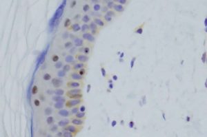 new-dna-test-finds-ans