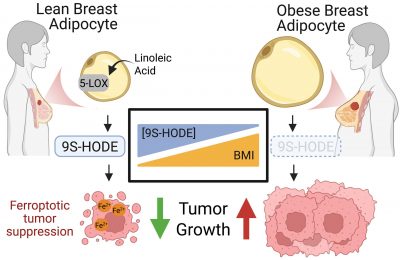 obesity-may-remove-a-n