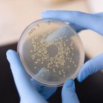 UTI-Causing-Bacterial-Colonies-1200x800