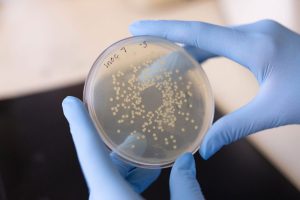UTI-Causing-Bacterial-Colonies-1200x800