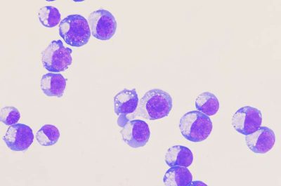 about-two-dozen-cells