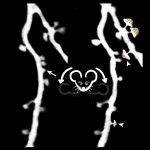 how-psilocybin-reshape