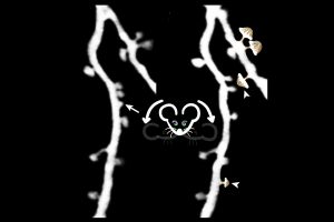 how-psilocybin-reshape