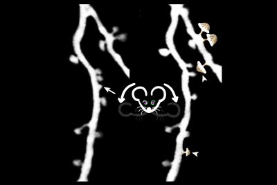 how-psilocybin-reshape