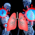 lung-2 (2)