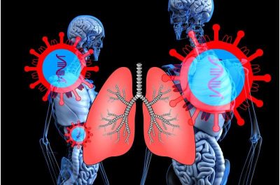 lung-2 (2)