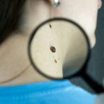 melanoma-vaccine-reduc